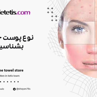 نوع پوست خود را بشناسید